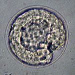 Fertilized Egg