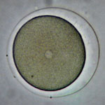 Fertilized Egg