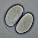 Two Cells